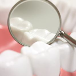 Closeup of teeth with dental sealants