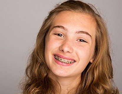 Dentist holding Invisalign aligners