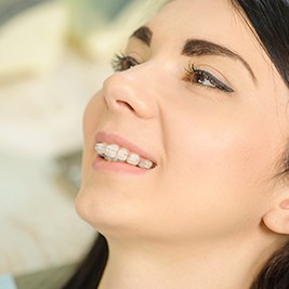 Woman with ceramic braces