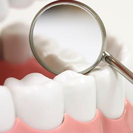 Closeup of teeth with dental sealants