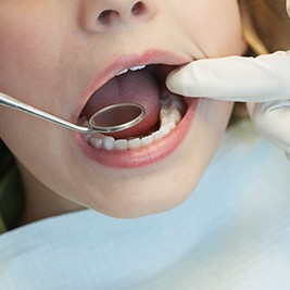 Closeup of child's smile during exam