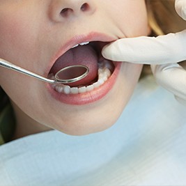 Closeup of child's smile being examined