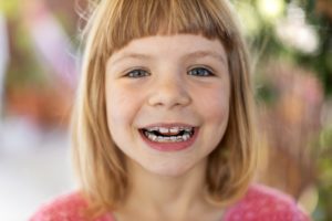 little girl with Phase 1 ortho