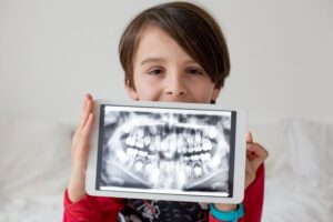Young boy holding a tablet displaying X-ray of his mouth